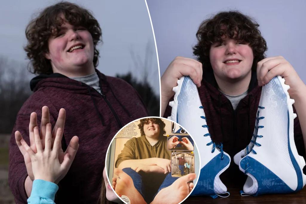 Teen sets world record for largest feet and hands: 'People are usually amazed'